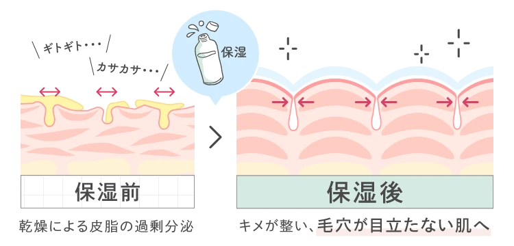 あなたの毛穴タイプは？